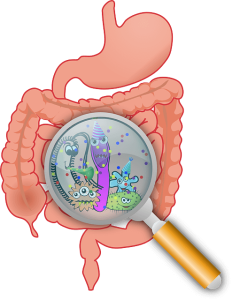 이종장기 이식 Xenotransplantation 시 형질전환 돼지 장기의 알파갈 Alpha-gal 제거와 초급성 거부반응 예방 기전